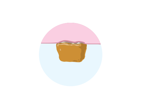 Ilustración del alimento cubriendo el diente